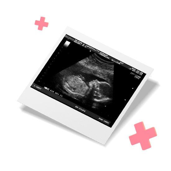 Ультразвуковая диагностика для беременнных