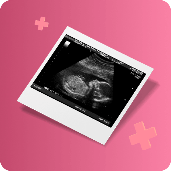 Сделать УЗИ (Ультразвуковую диагностику) беременным в Краснодаре: адреса и цены